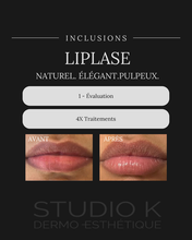 Charger l'image dans la galerie, PROMO JUIN - 4 Traitements Liplase