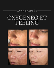 Charger l'image dans la galerie, PROMO JUIN - 2 Soins Oxygèneo &amp; recevez un Peeling MD Anti-Âge ou Anti-Acne GRATUIT
